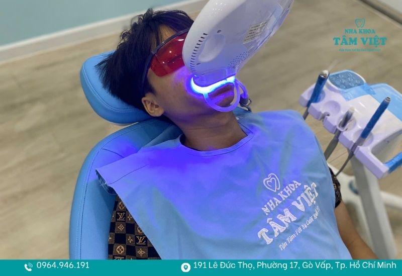 Tẩy trắng răng bằng thuốc và ánh sáng chuyên dụng