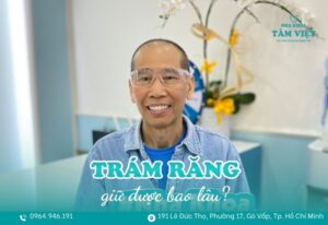 trám răng giữ được bao lâu