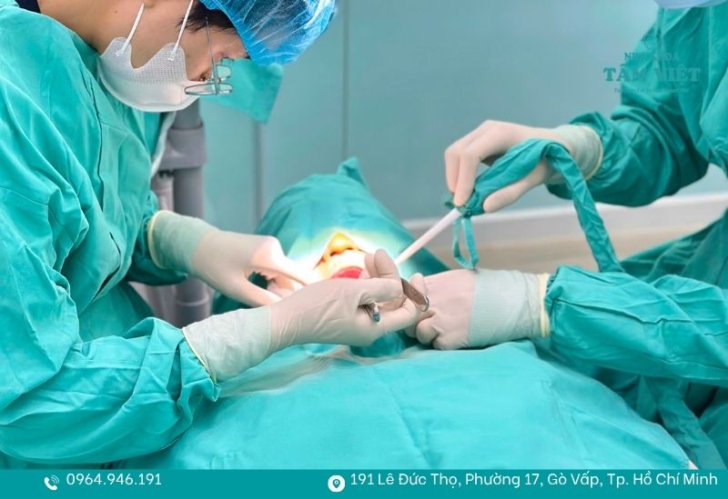 Giải pháp trồng răng giá rẻ tại TPHCM