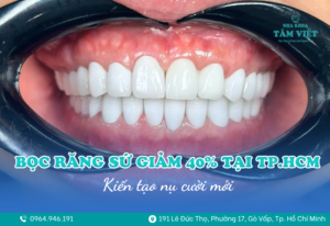 ưu đãi bọc răng sứ TP.HCM