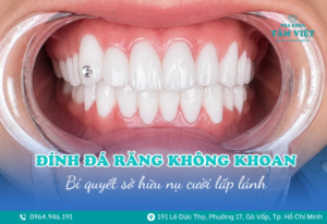 dinh-da-rang-khong-khoan