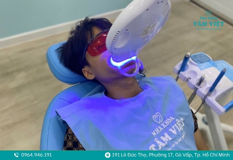 Tẩy trắng răng giá bao nhiêu? Bảng giá và lưu ý khi thực hiện 3 tẩy trắng răng giá bao nhiêu 3
