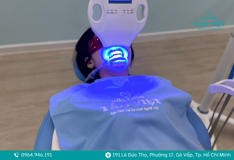 Tẩy trắng răng Gò Vấp giúp nụ cười trắng sáng tự nhiên 3 tẩy trắng răng Gò Vấp 3
